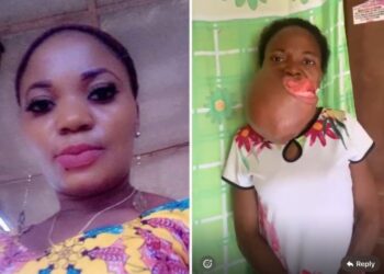 Nigerian Woman Diagnosed With Rare Oral Cancer Seeks ₦7m for Urgent Surgery