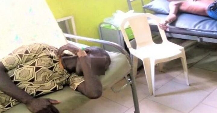 Eight residents die in Adamawa after suspected Buruli ulcer outbreak