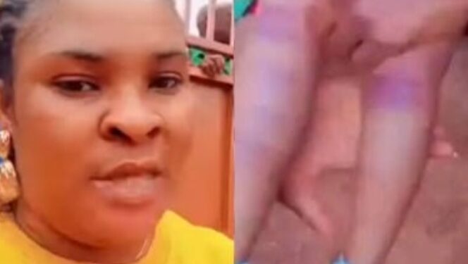 Enugu School Under Fire Over Assault on Nursery Pupil