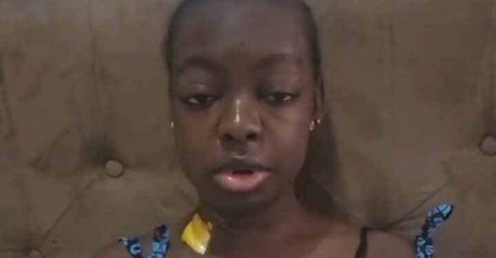 Tolulope Ajayi: Family Seeks N30m for UNILAG Graduate’s Kidney Transplant