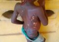 Woman Arrested for Allegedly Inflicting Hot Knife Injuries on Daughter in Anambra