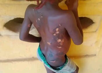 Woman Arrested for Allegedly Inflicting Hot Knife Injuries on Daughter in Anambra