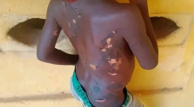 Woman Arrested for Allegedly Inflicting Hot Knife Injuries on Daughter in Anambra